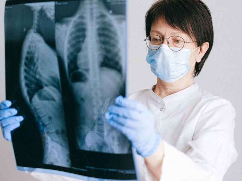 Phương pháp tự kiểm tra&nbsp;phổi